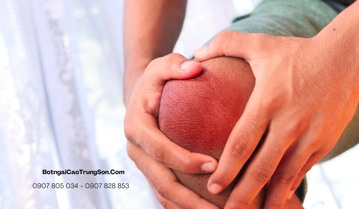 Ngải Đen hỗ trợ xương khớp